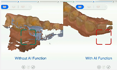 XL013 Dental Aoralscan 3